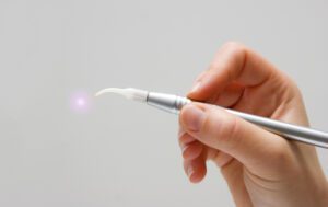 Benefits of Dental Lasers in Cadillac, Michigan