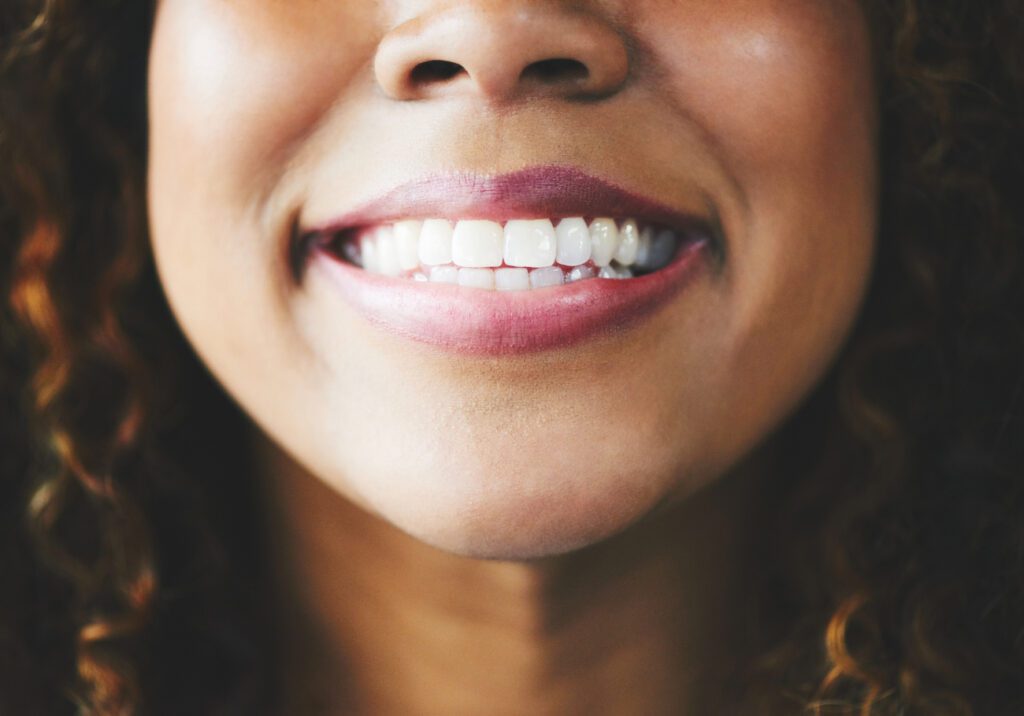 Patients could achieve a more uniform and attractive smile with porcelain veneers, enhancing their confidence.